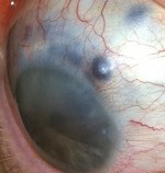 Mein Auge… Mein Auge…